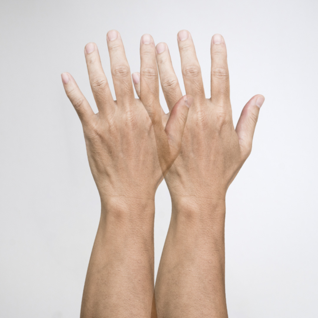 горизонтальное двоение в глазах