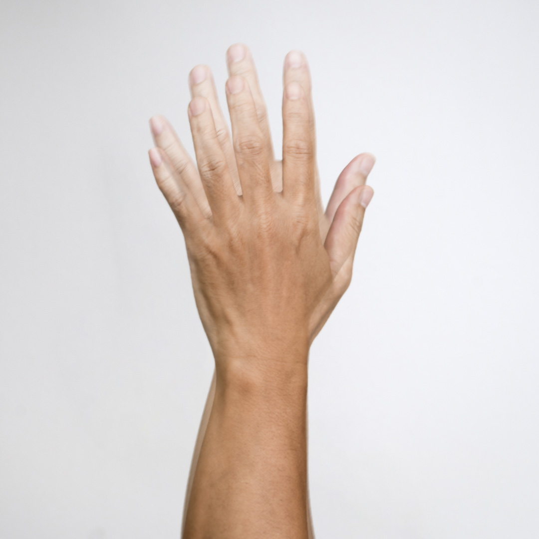 вертикальное двоение в глазах