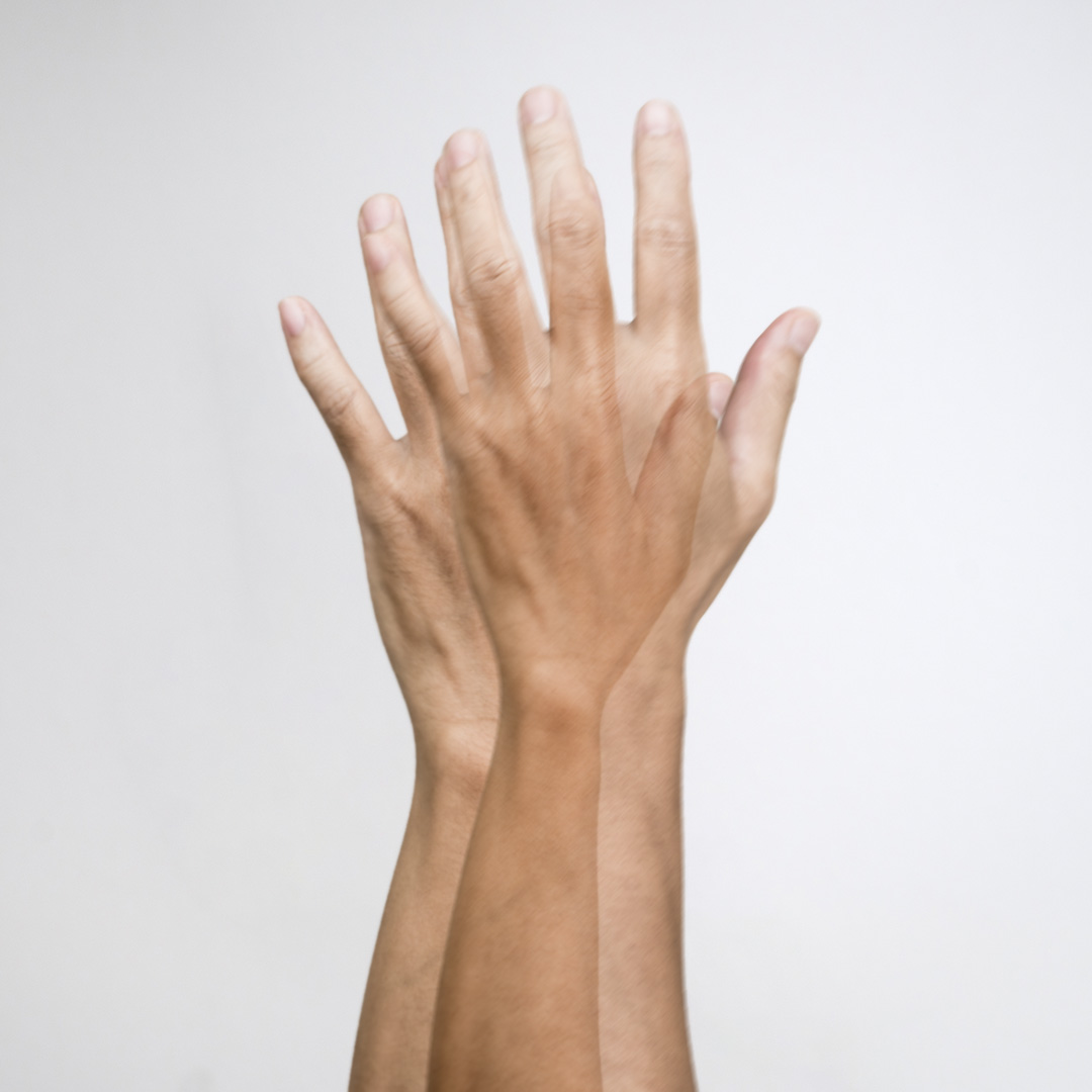 косое двоение в глазах