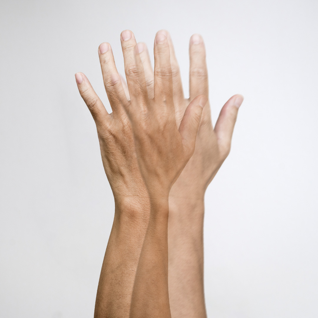 монокулярное двоение в глазах